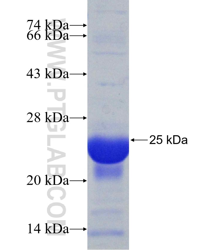 CBFB fusion protein Ag31183 SDS-PAGE