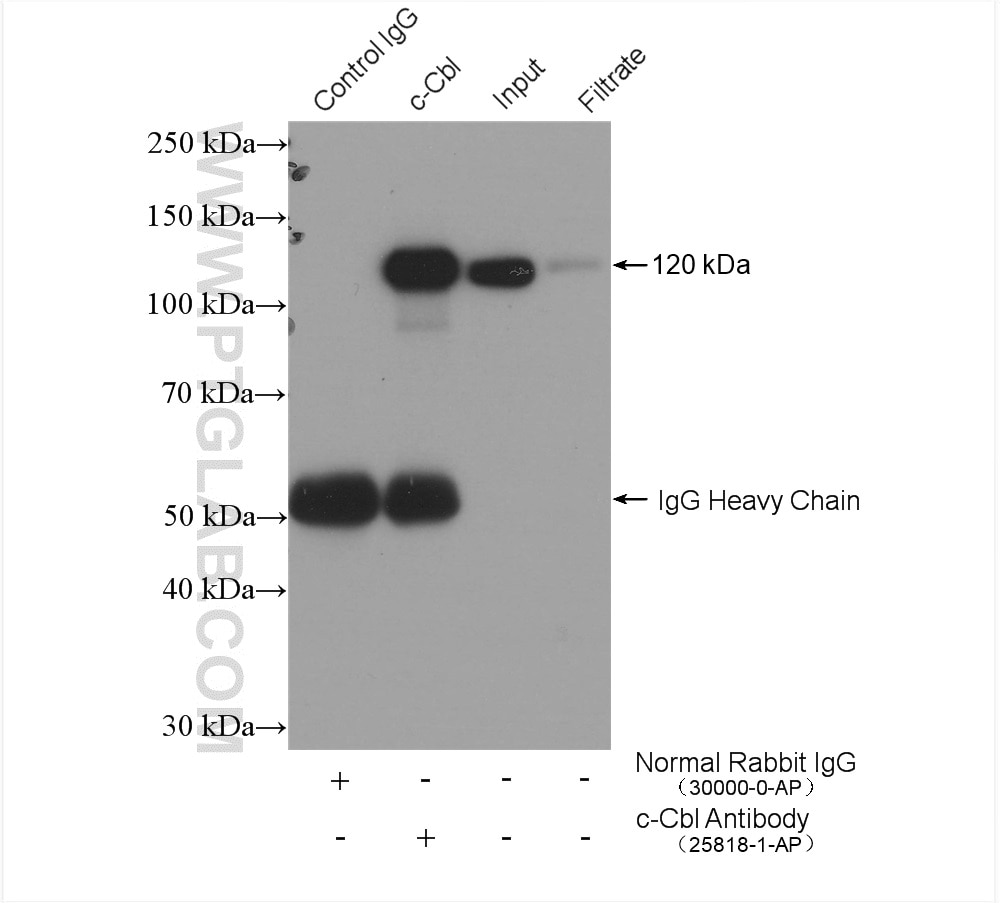 Immunoprecipitation (IP) experiment of K-562 cells using c-Cbl Polyclonal antibody (25818-1-AP)