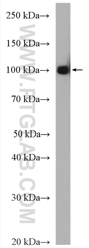 WB analysis of K-562 using 25818-1-AP