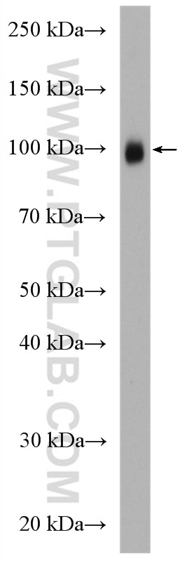 Western Blot (WB) analysis of K-562 cells using c-Cbl Polyclonal antibody (25818-1-AP)