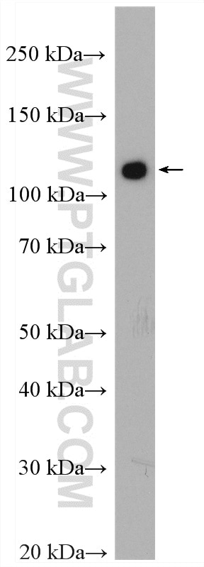 Western Blot (WB) analysis of K-562 cells using c-Cbl Polyclonal antibody (25818-1-AP)