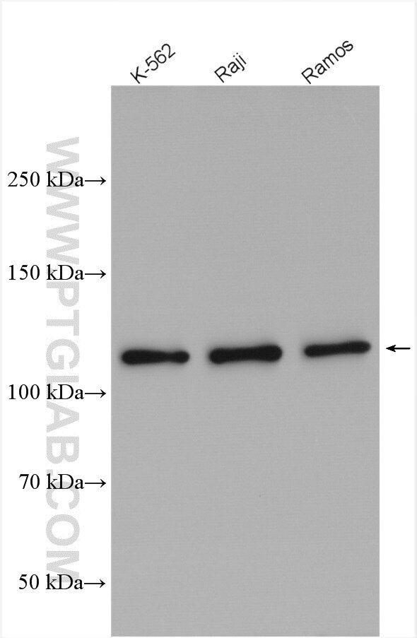 Western Blot (WB) analysis of various lysates using c-Cbl Polyclonal antibody (25818-1-AP)