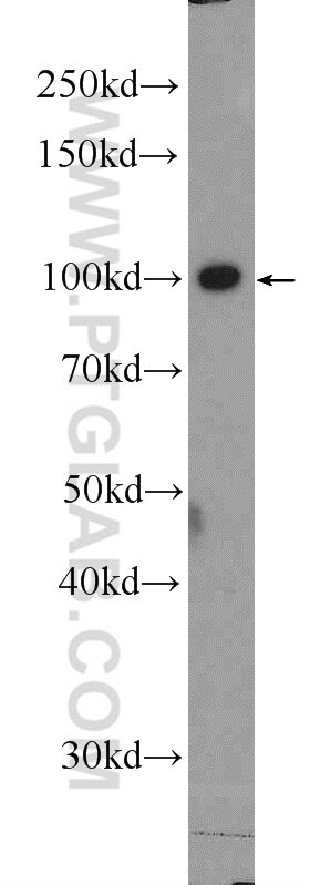 c-Cbl Polyclonal antibody