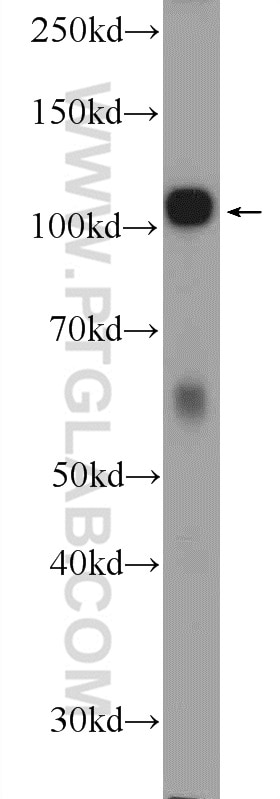 Western Blot (WB) analysis of Jurkat cells using c-Cbl Polyclonal antibody (25818-1-AP)