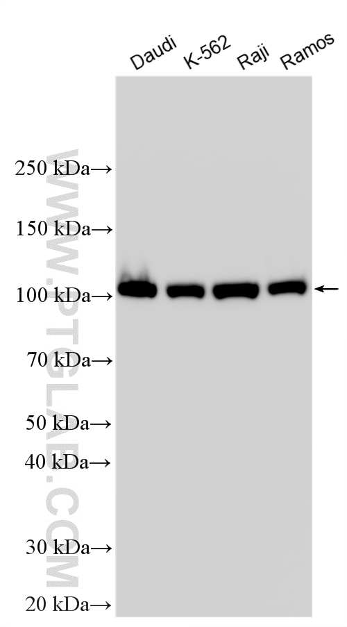 Various lysates were subjected to SDS PAGE followed by western blot with 25818-1-AP (c-Cbl antibody) at dilution of 1:10000 incubated at room temperature for 1.5 hours. Western Blot (WB) analysis of various lysates using c-Cbl Polyclonal antibody (25818-1-AP)
