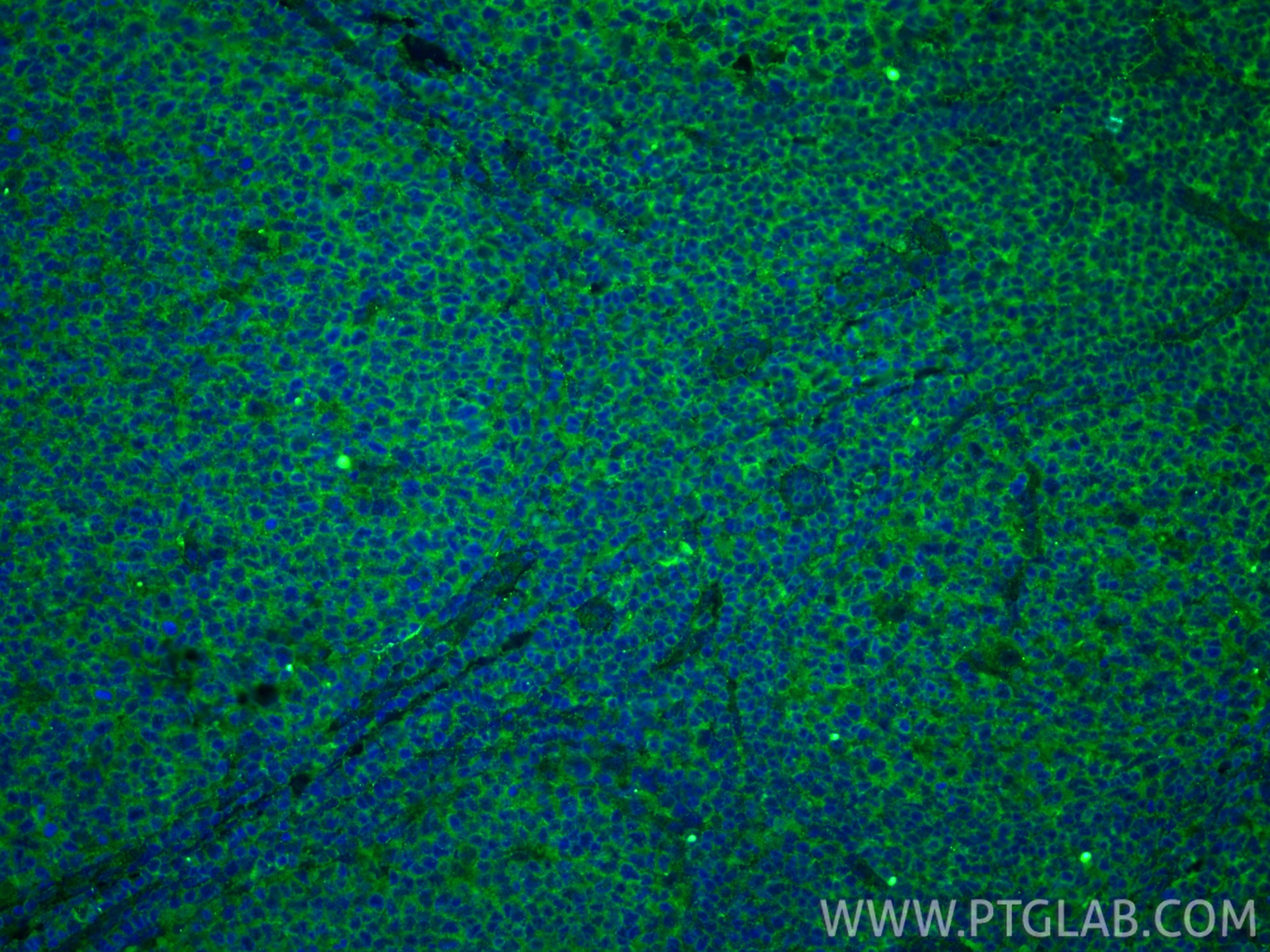 IF Staining of human tonsillitis using 66576-1-Ig Immunofluorescence (IF) / fluorescent staining of human tonsillitis tissue using c-Cbl Monoclonal antibody (66576-1-Ig)