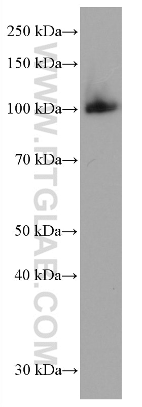 Western Blot (WB) analysis of Daudi cells using c-Cbl Monoclonal antibody (66576-1-Ig)