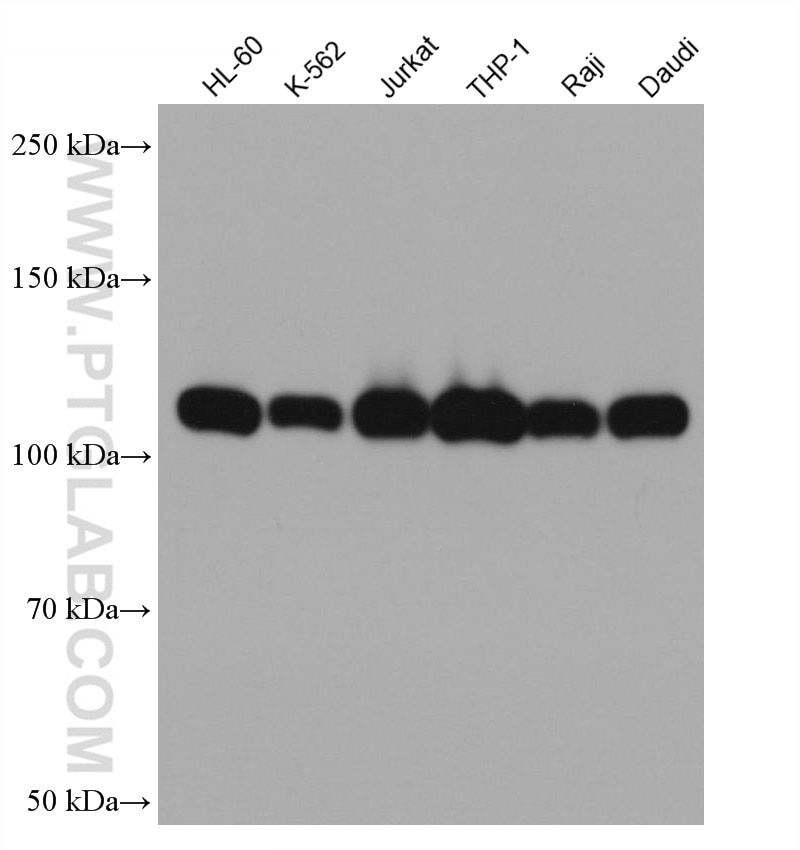 Western Blot (WB) analysis of various lysates using c-Cbl Monoclonal antibody (66576-1-Ig)