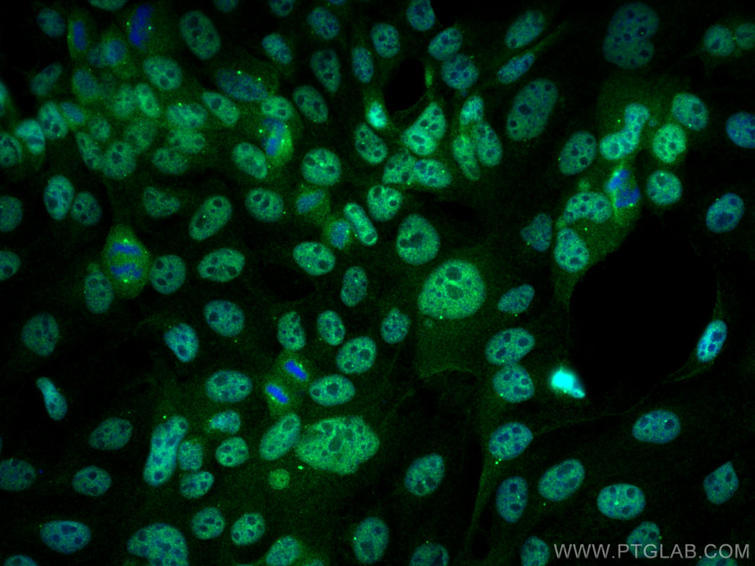 Immunofluorescence (IF) / fluorescent staining of A431 cells using CBLB Polyclonal antibody (12781-1-AP)
