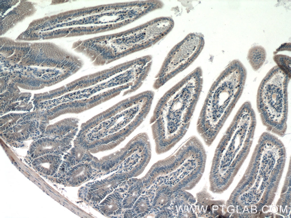 Immunohistochemistry (IHC) staining of mouse colon tissue using CBLB Polyclonal antibody (12781-1-AP)