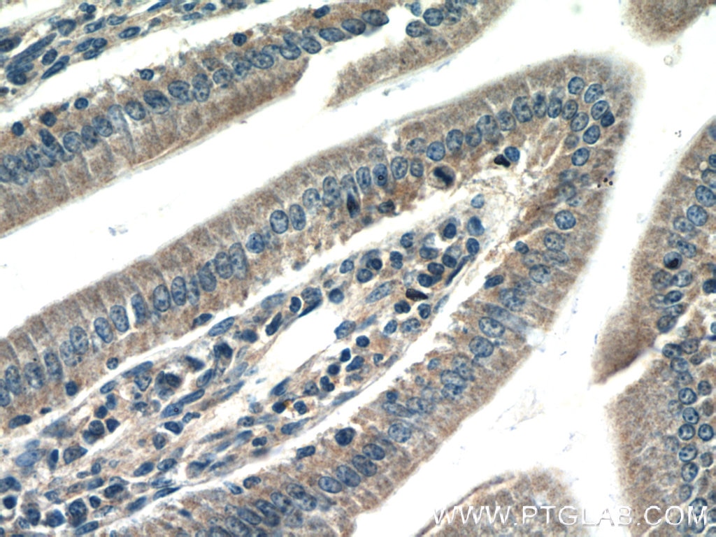 Immunohistochemistry (IHC) staining of mouse colon tissue using CBLB Polyclonal antibody (12781-1-AP)