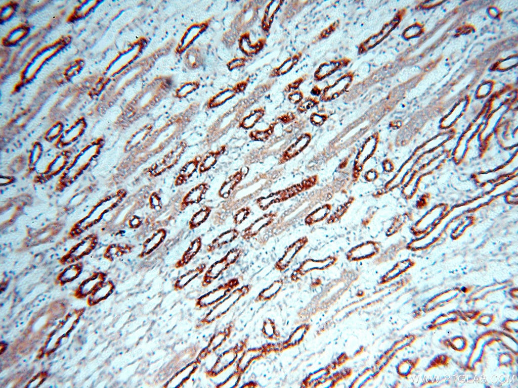 Immunohistochemistry (IHC) staining of human kidney tissue using CBLB Polyclonal antibody (12781-1-AP)