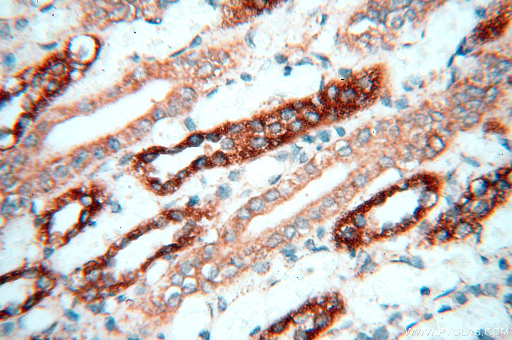 Immunohistochemistry (IHC) staining of human kidney tissue using CBLB Polyclonal antibody (12781-1-AP)