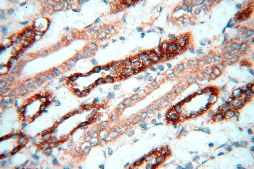 IHC staining of human kidney using 12781-1-AP