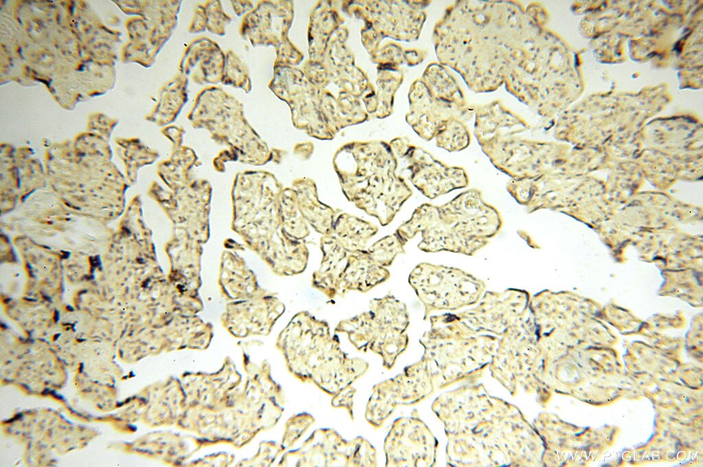 Immunohistochemistry (IHC) staining of human placenta tissue using CBLB Polyclonal antibody (12781-1-AP)