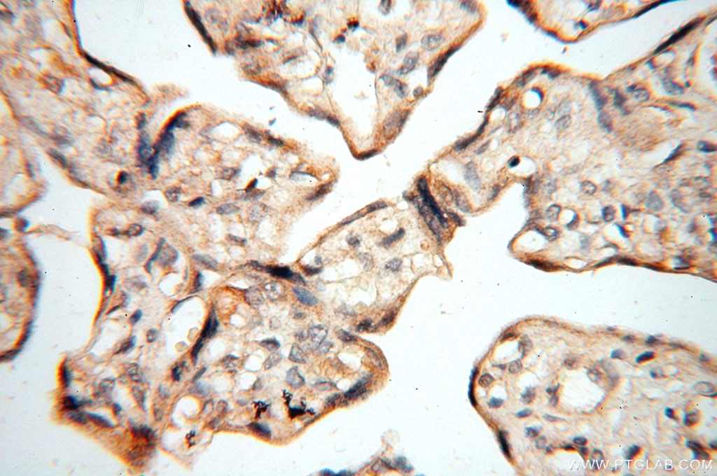 Immunohistochemistry (IHC) staining of human placenta tissue using CBLB Polyclonal antibody (12781-1-AP)