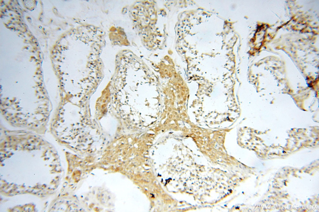 Immunohistochemistry (IHC) staining of human testis tissue using CBLB Polyclonal antibody (12781-1-AP)