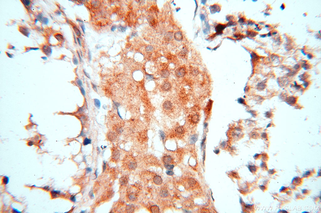 Immunohistochemistry (IHC) staining of human testis tissue using CBLB Polyclonal antibody (12781-1-AP)