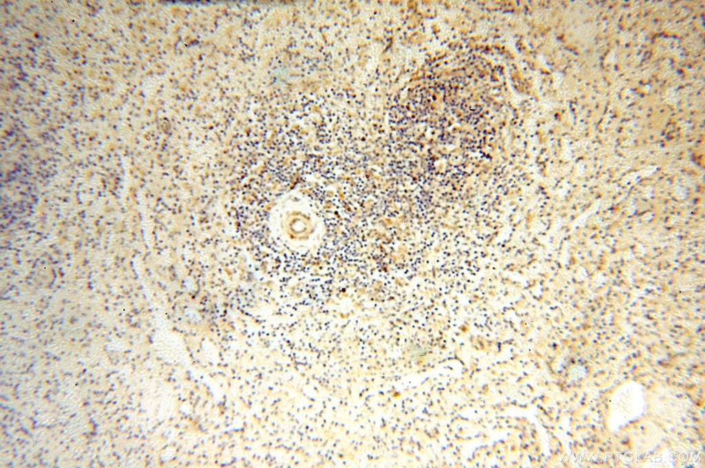 Immunohistochemistry (IHC) staining of human spleen tissue using CBLB Polyclonal antibody (12781-1-AP)