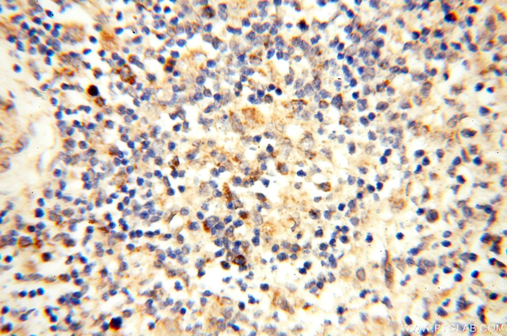 Immunohistochemistry (IHC) staining of human spleen tissue using CBLB Polyclonal antibody (12781-1-AP)