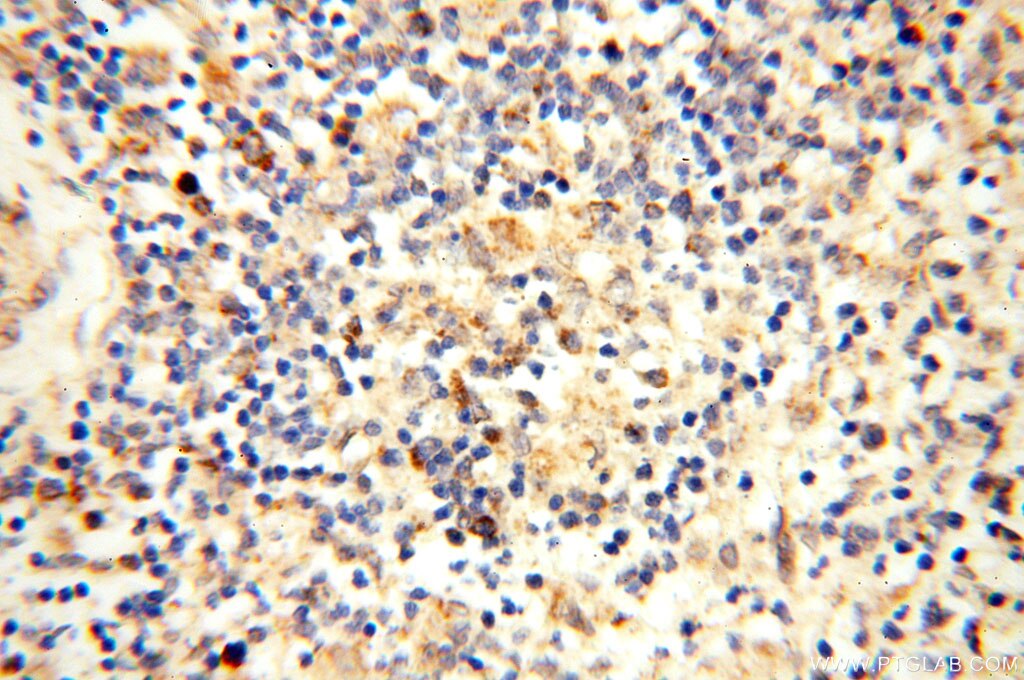 IHC staining of human spleen using 12781-1-AP