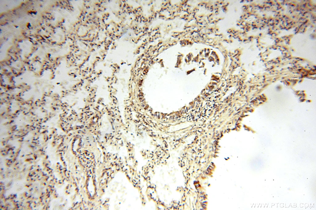 Immunohistochemistry (IHC) staining of human lung tissue using CBLB Polyclonal antibody (12781-1-AP)