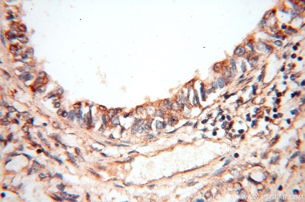 IHC staining of human lung using 12781-1-AP