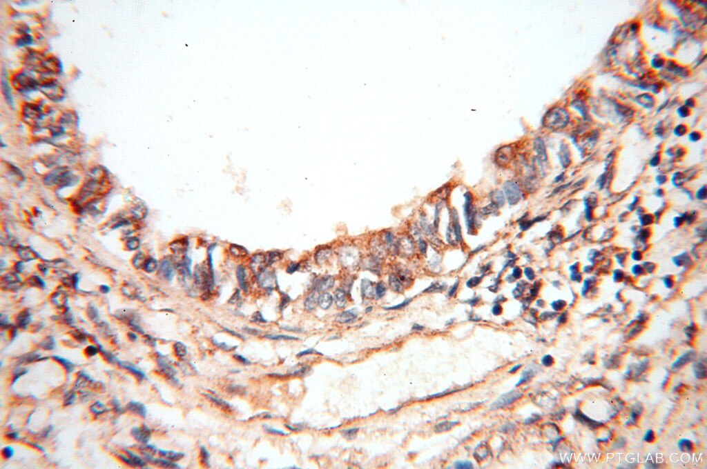 Immunohistochemistry (IHC) staining of human lung tissue using CBLB Polyclonal antibody (12781-1-AP)