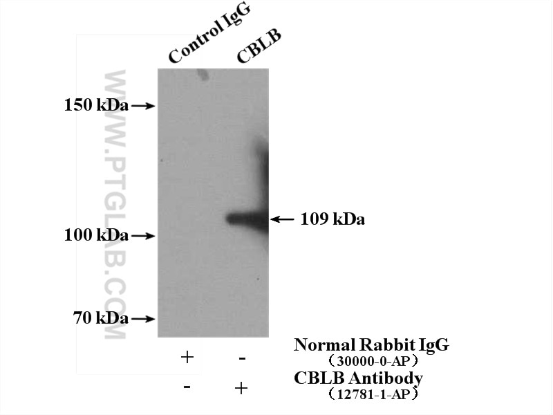 Immunoprecipitation (IP) experiment of HEK-293 cells using CBLB Polyclonal antibody (12781-1-AP)