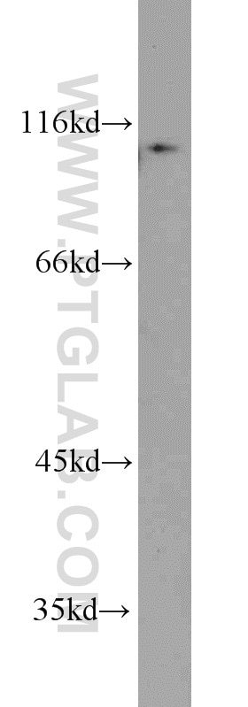 Western Blot (WB) analysis of A549 cells using CBLB Polyclonal antibody (12781-1-AP)