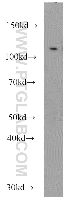 Western Blot (WB) analysis of A549 cells using CBLB Polyclonal antibody (12781-1-AP)