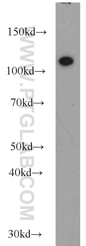 Western Blot (WB) analysis of A549 cells using CBLB Polyclonal antibody (12781-1-AP)