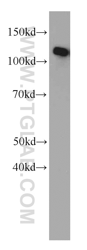 Western Blot (WB) analysis of HEK-293 cells using CBLB Polyclonal antibody (12781-1-AP)