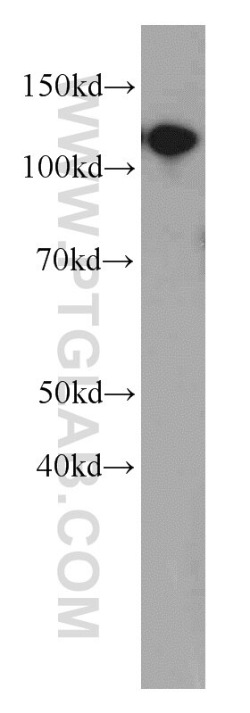 Western Blot (WB) analysis of HEK-293 cells using CBLB Polyclonal antibody (12781-1-AP)