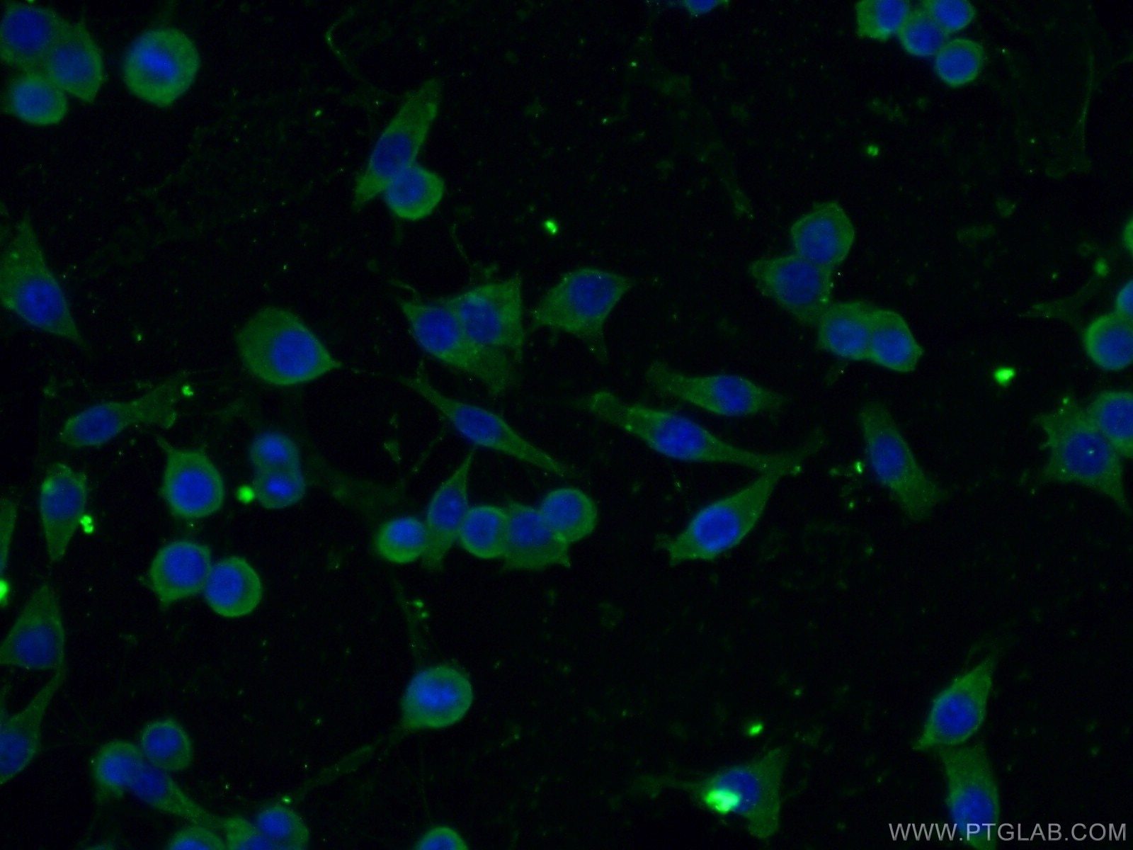 Immunofluorescence (IF) / fluorescent staining of RAW 264.7 cells using CBLB Monoclonal antibody (66353-1-Ig)