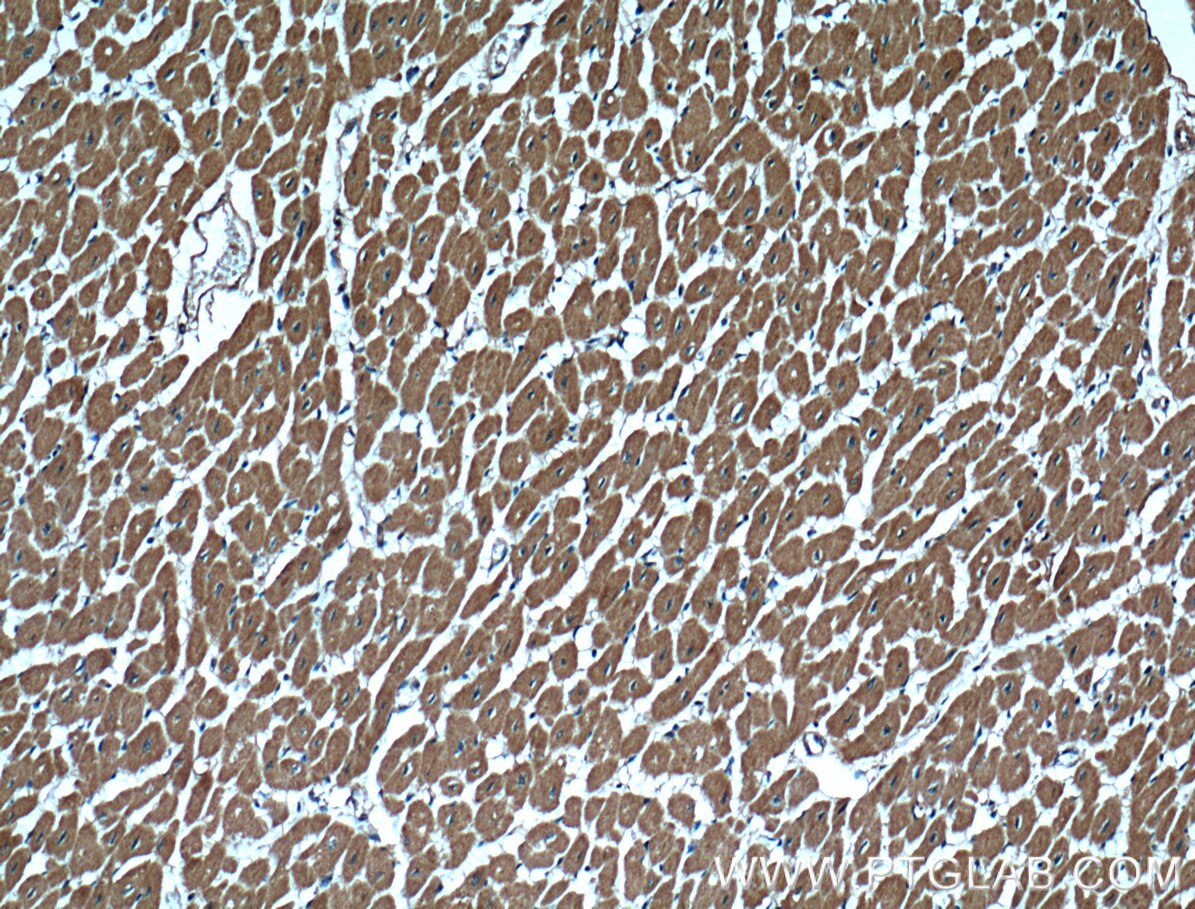 Immunohistochemistry (IHC) staining of human heart tissue using CBLB Monoclonal antibody (66353-1-Ig)