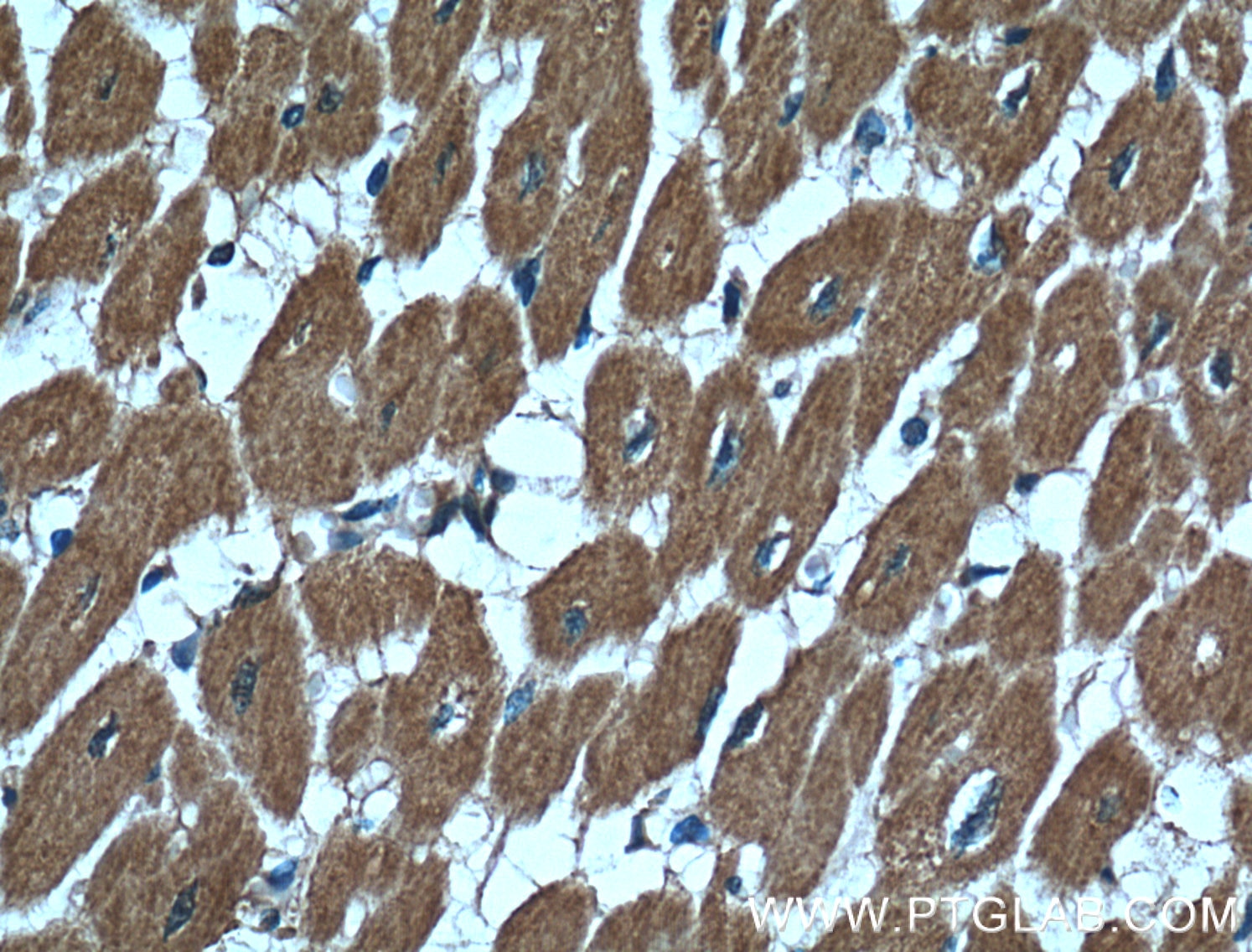 Immunohistochemistry (IHC) staining of human heart tissue using CBLB Monoclonal antibody (66353-1-Ig)