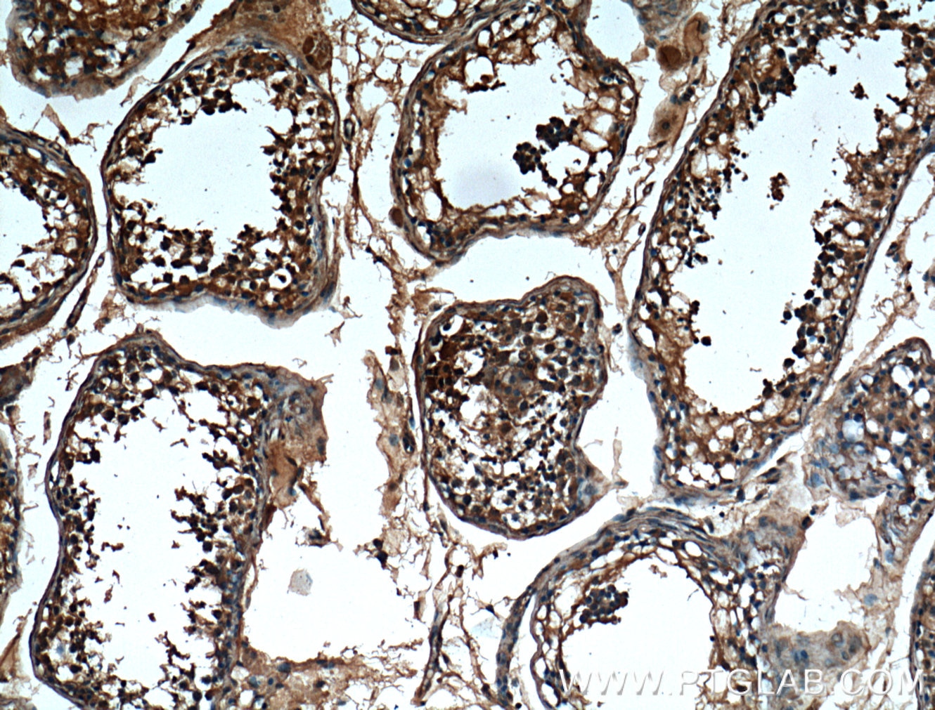 Immunohistochemistry (IHC) staining of human testis tissue using CBLB Monoclonal antibody (66353-1-Ig)