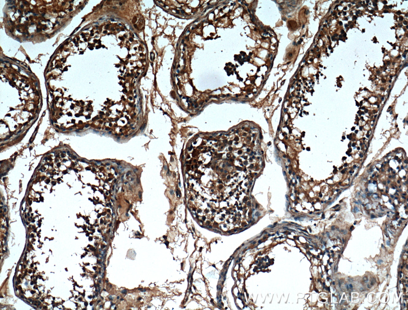 IHC staining of human testis using 66353-1-Ig