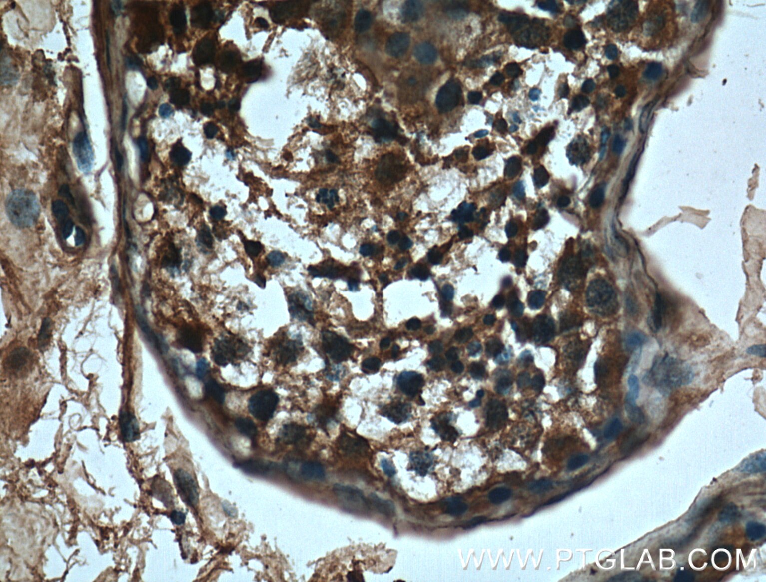 Immunohistochemistry (IHC) staining of human testis tissue using CBLB Monoclonal antibody (66353-1-Ig)