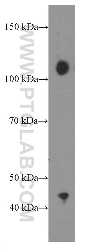 Western Blot (WB) analysis of RAW 264.7 cells using CBLB Monoclonal antibody (66353-1-Ig)