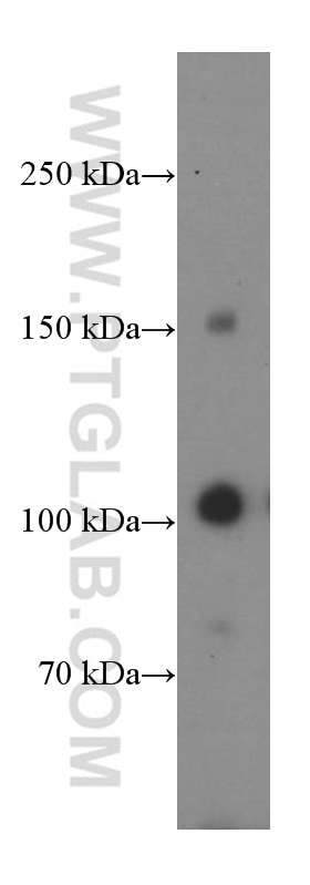 Western Blot (WB) analysis of rat heart tissue using CBLB Monoclonal antibody (66353-1-Ig)