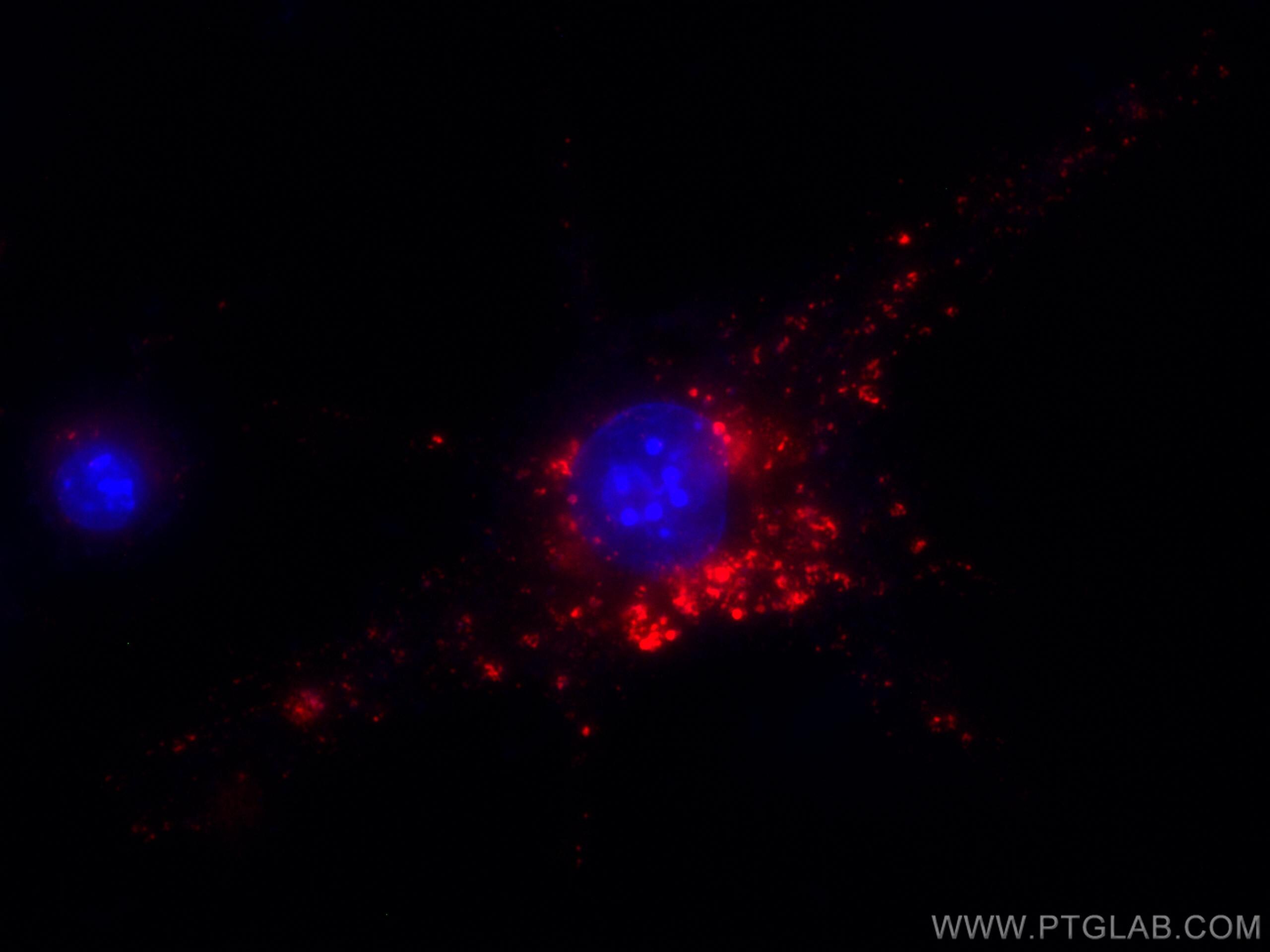 Immunofluorescence (IF) / fluorescent staining of RAW 264.7 cells using CoraLite®594-conjugated CBLB Monoclonal antibody (CL594-66353)