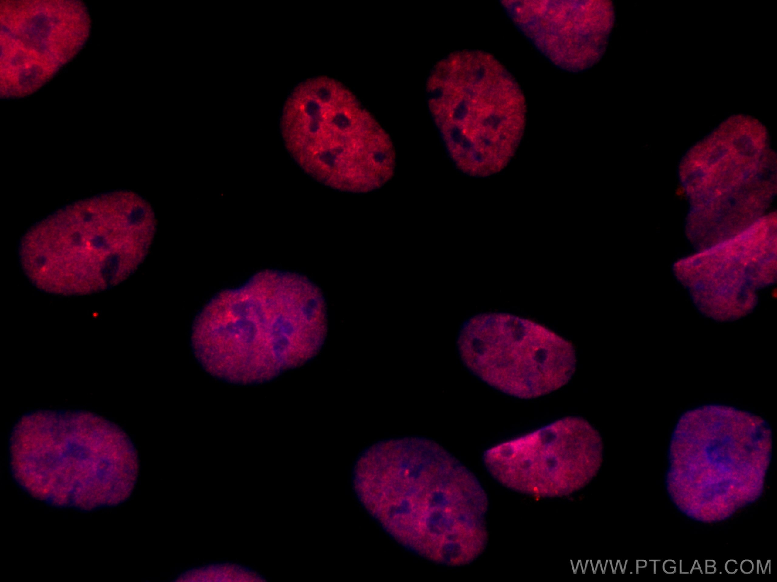 Immunofluorescence (IF) / fluorescent staining of U2OS cells using CoraLite®594-conjugated CBLB Monoclonal antibody (CL594-66353)