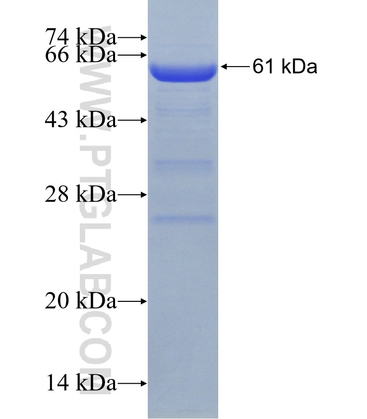 CBLB fusion protein Ag31210 SDS-PAGE CBLB fusion protein Ag31210 SDS-PAGE