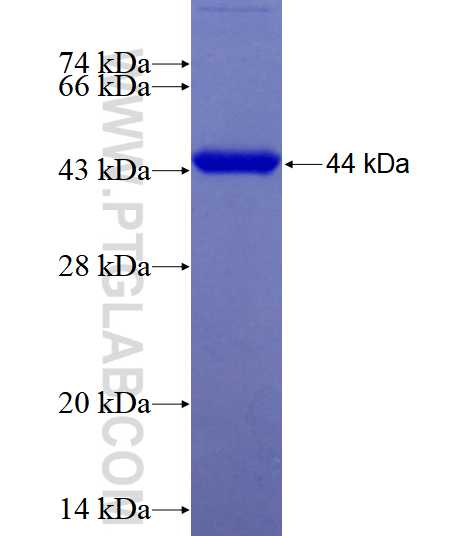 CBLB fusion protein Ag18757 SDS-PAGE