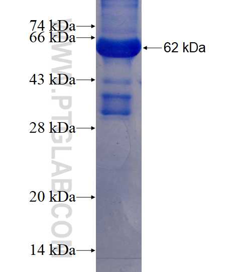 CBLB fusion protein Ag3491 SDS-PAGE