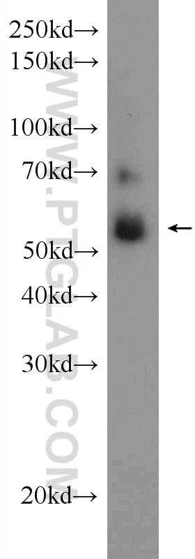 Western Blot (WB) analysis of rat colon tissue using CBLC Polyclonal antibody (13104-1-AP)