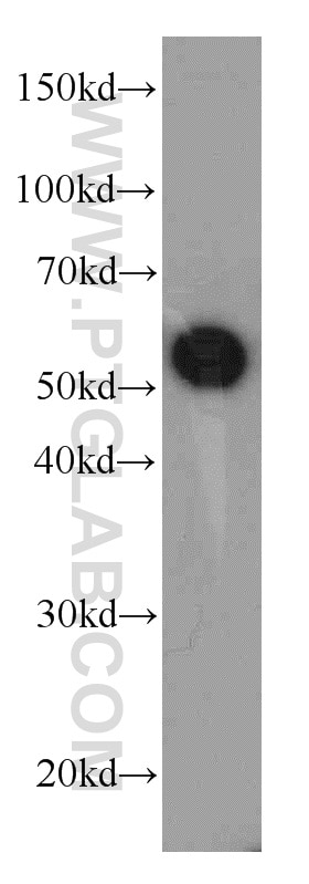 Western Blot (WB) analysis of L02 cells using CBLC Polyclonal antibody (13104-1-AP)