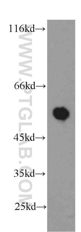 Western Blot (WB) analysis of mouse lung tissue using CBLC Polyclonal antibody (13104-1-AP)